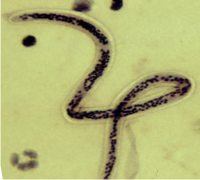 nematodi, vermetti da orto